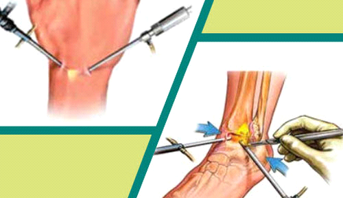 Chương trình CME chuyên đề: Phẫu thuật nội soi khớp cổ tay – cổ chân