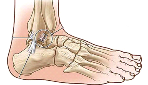 Hội thảo khoa học chuyên đề: Tổn thương vùng khớp cổ chân: chẩn đoán và điều trị